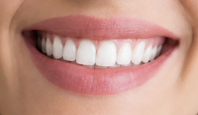 Shade simulation: the same teeth with a bright, whitened shade